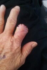 finger-after
