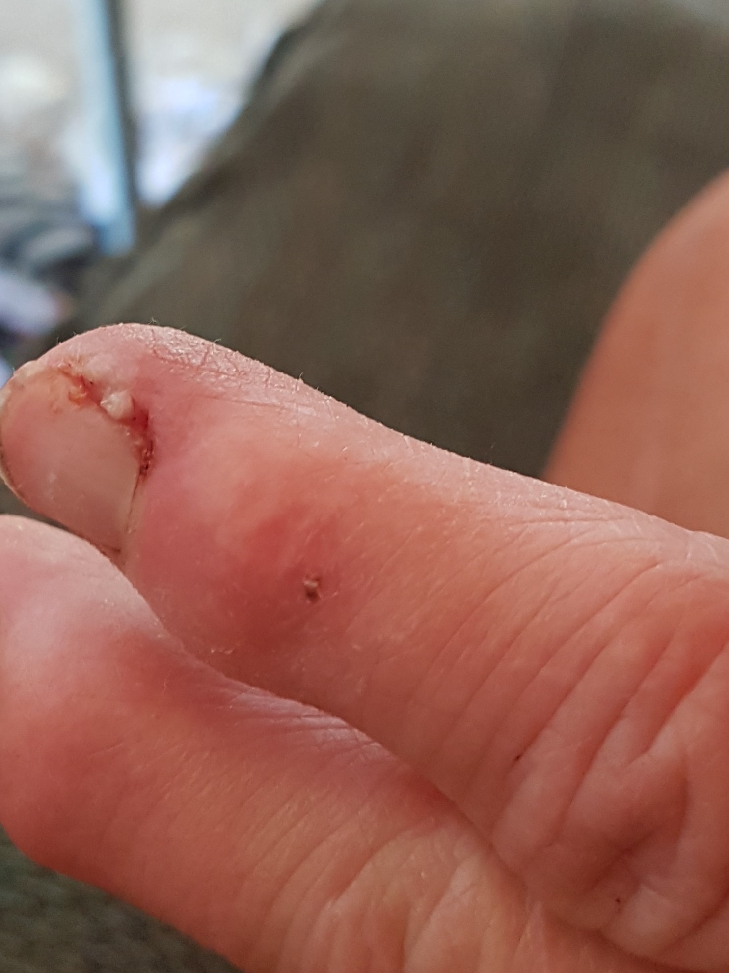 6-6 finger smash n tear (2)